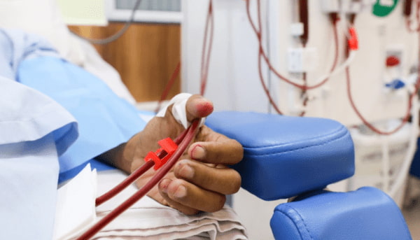 Bệnh nhân suy thận giai đoạn cuối lọc máu chạy thận. Ảnh: Phùng Tiên